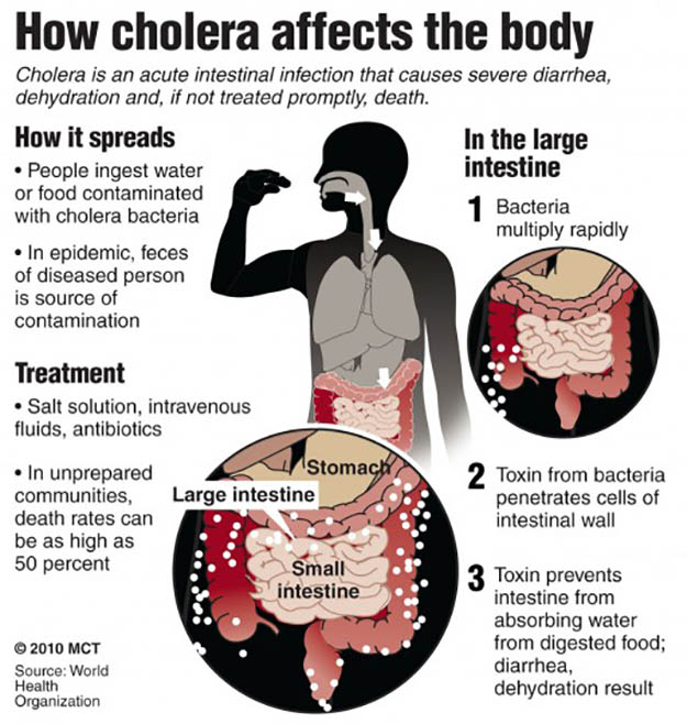 shtf-diseases-cholera