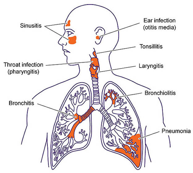 shtf-diseases-respiratory-infections