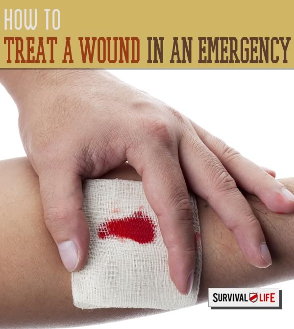 medical preparedness, treating a wound, how to treat a wound, emergency preparedness