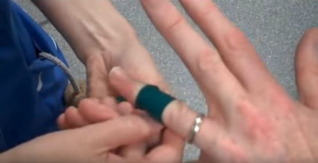 Wrap Elastics Around Your Fingers | Ring Stuck On Finger? This Cool Trick Could Save Your Finger... And Your Ring