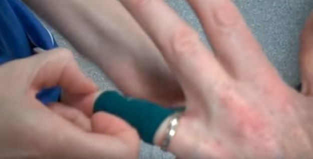 Wrap Elastics Tightly | Ring Stuck On Finger? This Cool Trick Could Save Your Finger... And Your Ring