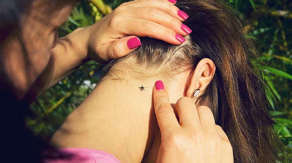 Feature | How to Remove Ticks from your Skin | Ticks
