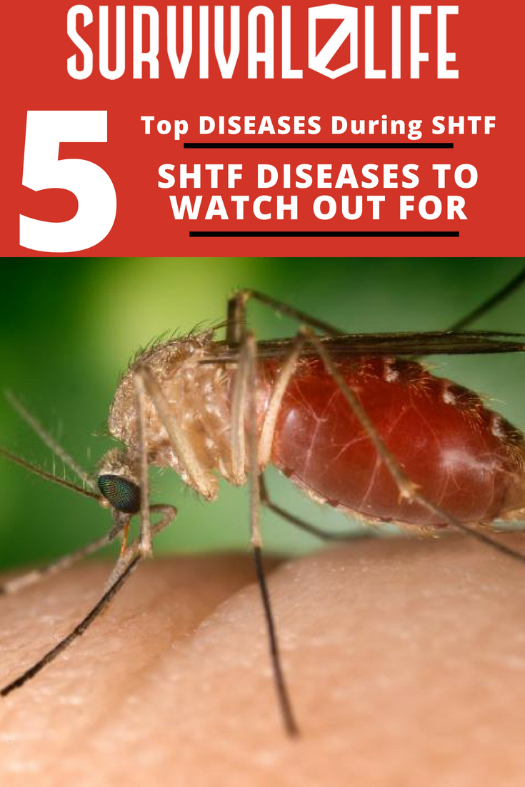 SHTF DISEASES TO WATCH OUT FOR