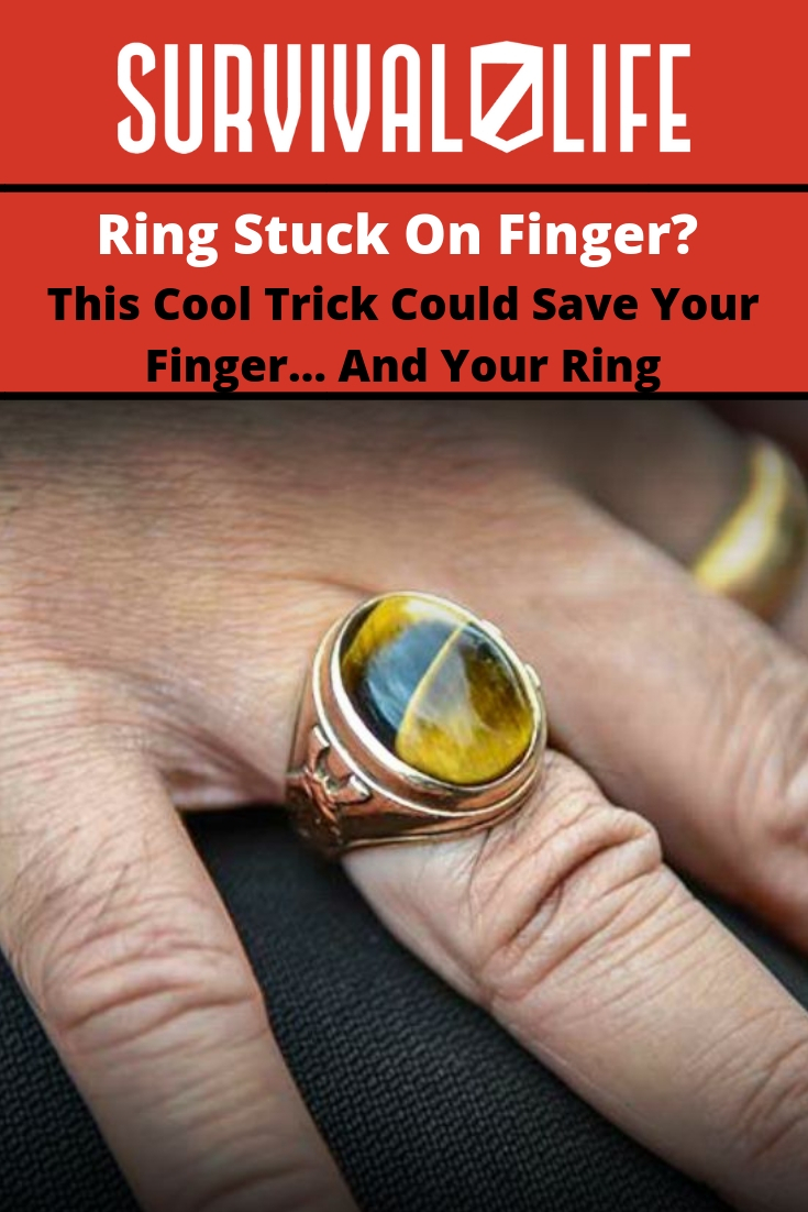 Ring Stuck On Finger? This Trick Could Save Your Finger And Your Ring | https://survivallife.com/get-stuck-ring-off-finger/