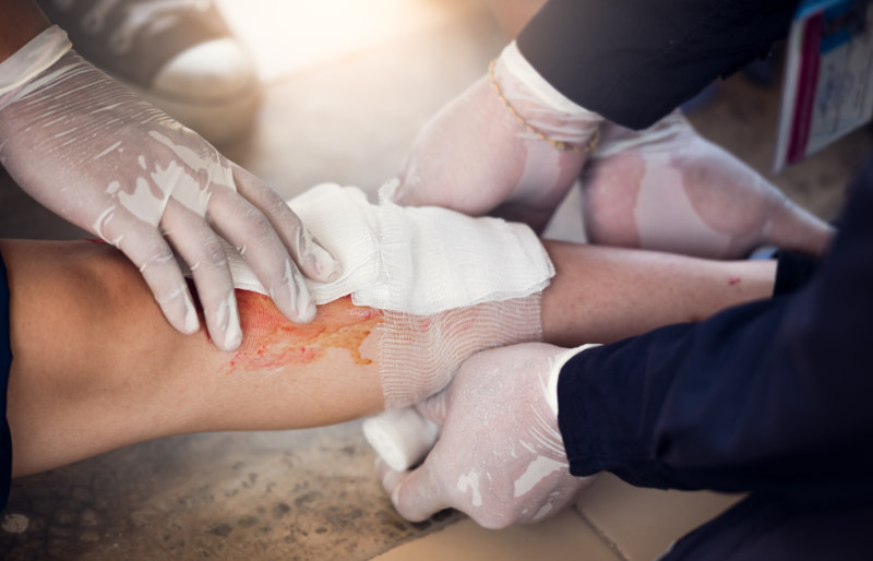 first aid training leg injury concept | wilderness first aid