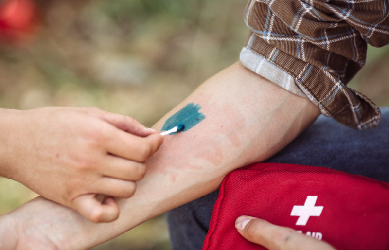 person treating his friends wound medicine | wilderness first aid