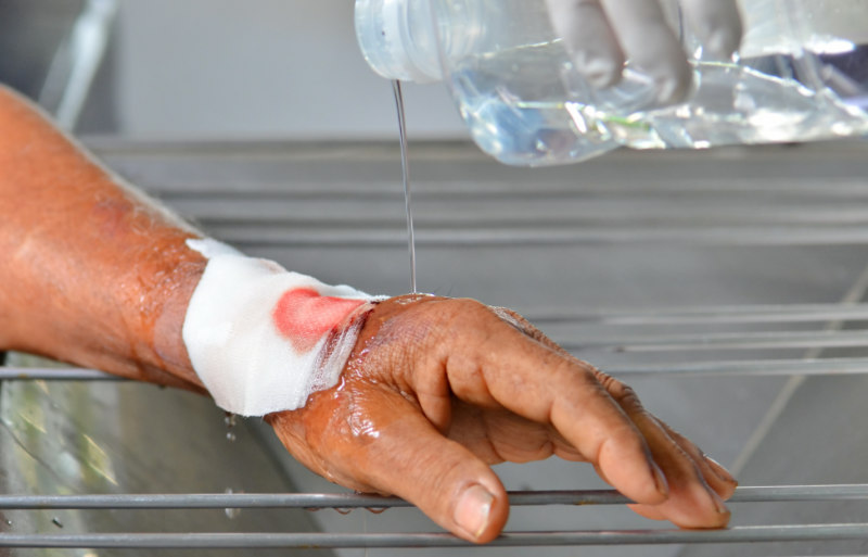 process cleaning wound by normal saline | wilderness first aid